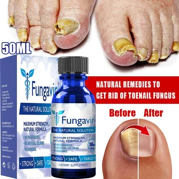 Супер силен лечение на гъбички на ноктите, най-доброто ремонт на ноктите, предотвратяване на растежа на плесен, възстановяване и обновяване на повредени, счупени